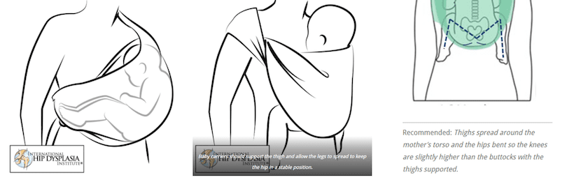Illustration of a baby in an M-position inside a baby carrier, demonstrating proper ergonomic support for healthy hip development.