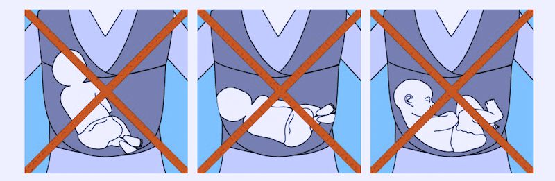 Illustration showing incorrect baby carrier positions, including face covered, baby sitting too low, and chin touching chest.