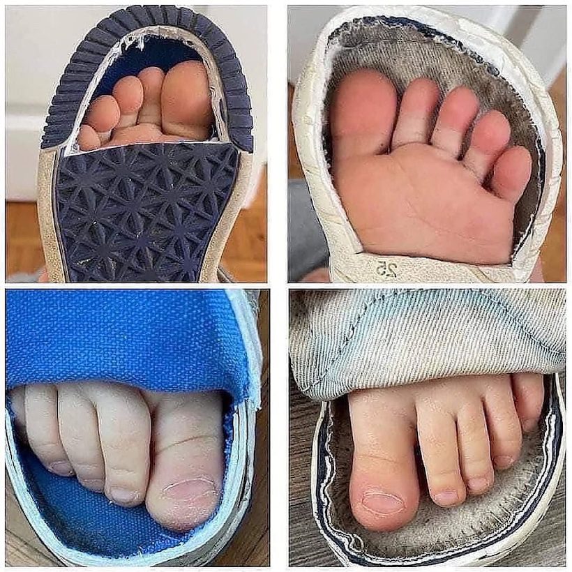 This image illustrates the importance of proper footwear for growing feet, showing how shoe shape can affect natural foot development