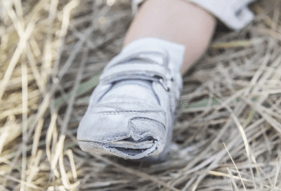 Photo Showing Damaged Shoes at Toe Box