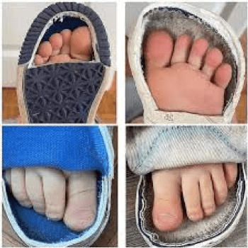 Wide Toe Box Illustration Showing Correct Fitting